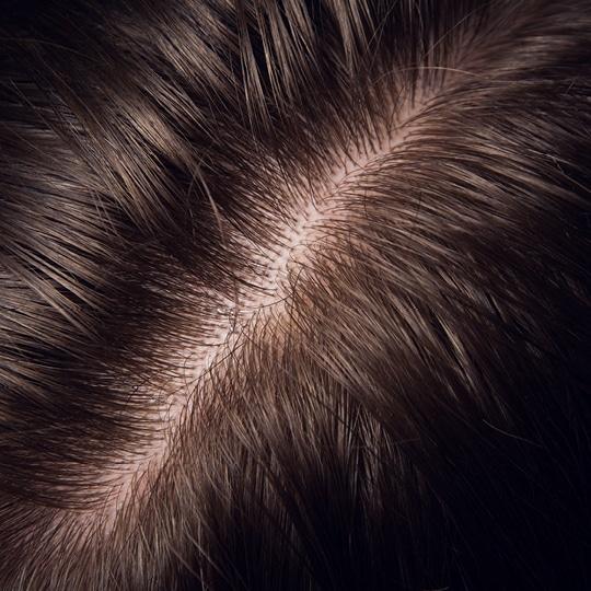 Noreva_Peau_Cheveux-cuir-sensible_Signe3_540x540