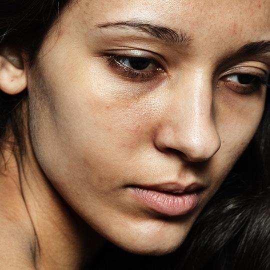 Noreva_Peau_Rides_Eclatettaches_540x540