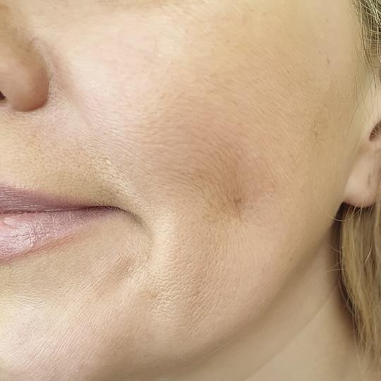 Noreva_Peau_Rides_Manquedefermete_540x540