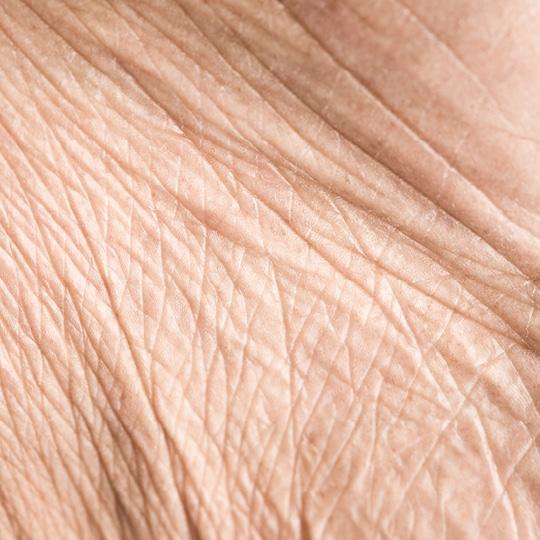 Noreva_Peau_Rides_Peauaffineeetridee_540x540