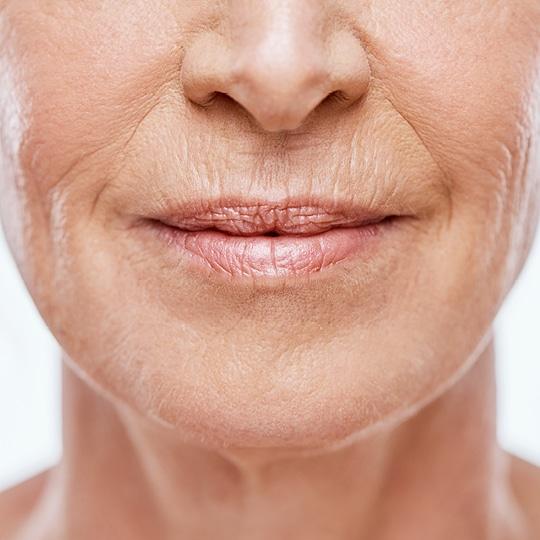 Noreva_Peau_Rides_Pertedevolume_540x540