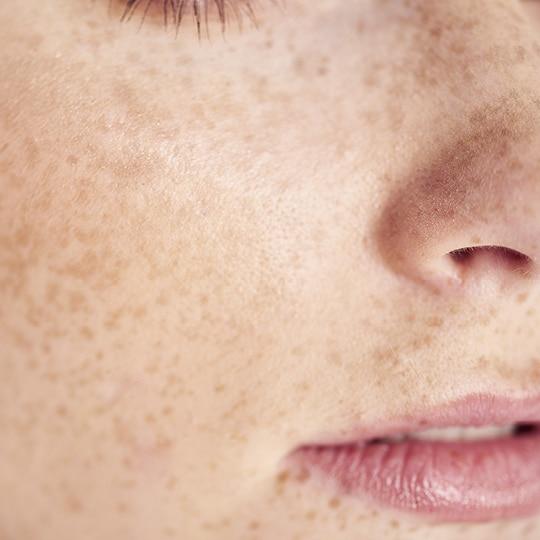 Noreva_Peau_Sensible_Reactive_540x540