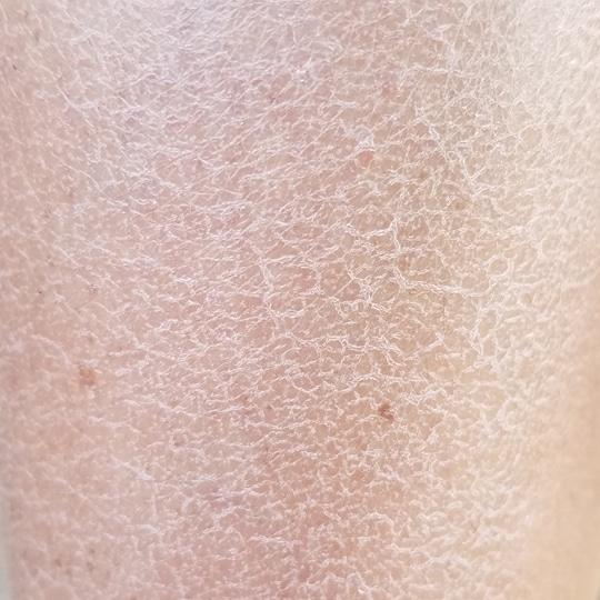 Noreva_Peau_Xerodiane-peau croco_Signe1_540x540